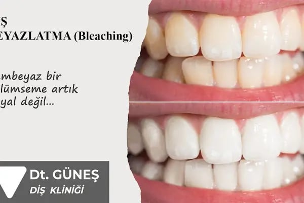 Diş Hekimi Refet GÜNEŞ - Resim 8