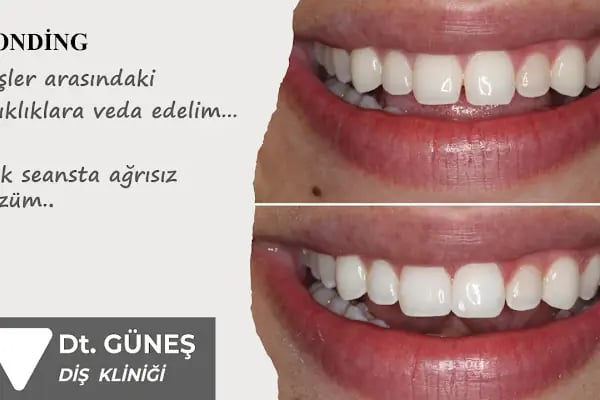 Diş Hekimi Refet GÜNEŞ - Resim 13