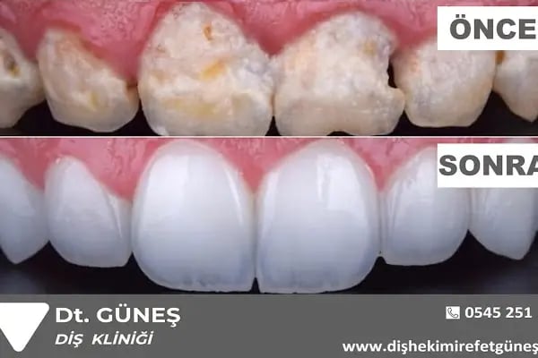 Diş Hekimi Refet GÜNEŞ - Resim 14