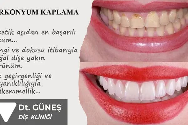 Diş Hekimi Refet GÜNEŞ - Resim 12
