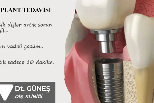 Diş Hekimi Refet GÜNEŞ - Resim 15