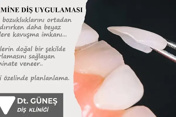 Diş Hekimi Refet GÜNEŞ - Resim 16